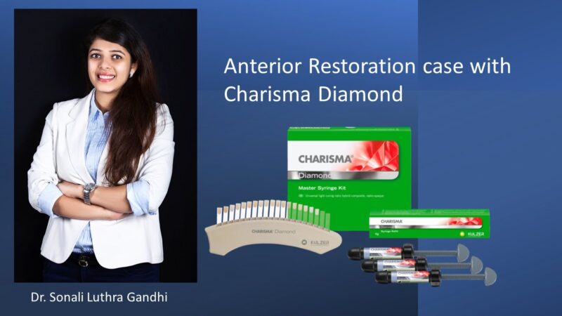 Charisma-Diamond-Anterior-Restoration-protocol-with-3-months-follow-up
