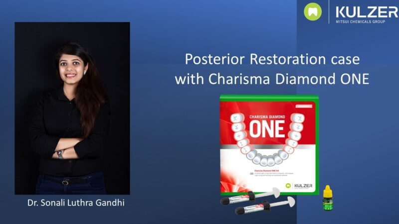 Charisma-Diamond-ONE-Clinical-protocol