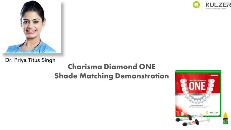 Charisma-Diamond-ONE-Shade-Match-Demonstration