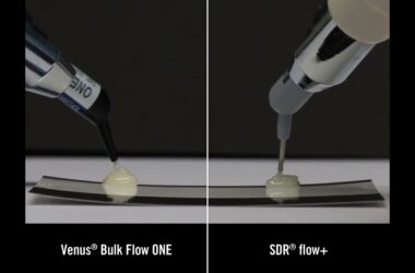 Test-de-fluidez-de-Venus-Bulk-Flow-ONE-comparado-con-SDR-Flow